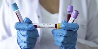 Koronavirüs tedavisi için kullanılan Kevzara, 7 ülkede denenmeye başlandı