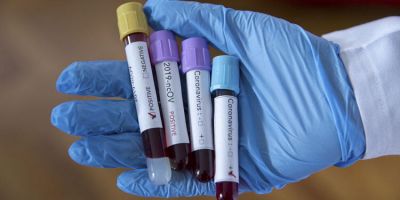 Prof.Dr. İlhami Çelik, koronavirüsün ne zaman ortadan kalkacağını açıkladı