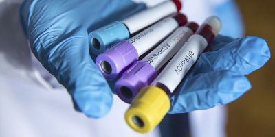 Rusya'da bir günde 6 bin yeni koronavirüs vakası