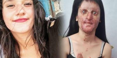 Berfin Özbek, aldığı ani bir karar ile asitli saldırganı affetti