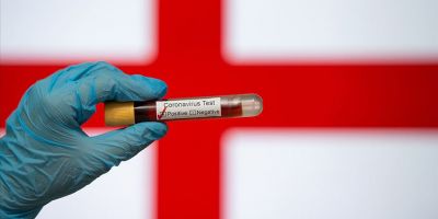 İngiltere'de Kovid-19 ölümleri 21 bini aştı