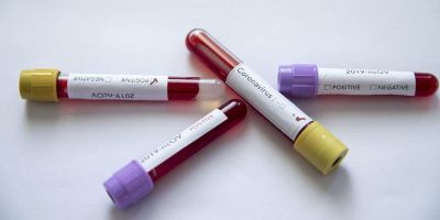 Bilim Kurulu Üyesinden 'Kurban Bayramı' uyarısı