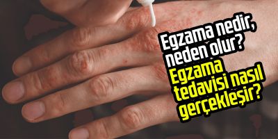 Egzama nedir, neden olur? Egzama tedavisi nasıl gerçekleşir?