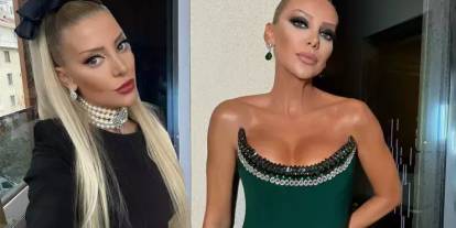Gülşah Saraçoğlu'nun estetik ameliyatı 9 saat sürdü: Son halini paylaştı, görenleri şok etti!