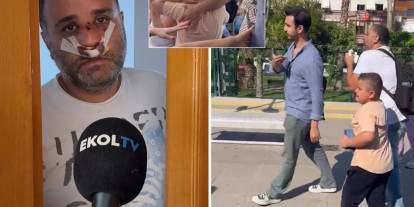 Çocuklarının gözü önünde dövüldü: Darp edilen o baba sessizliğini bozdu!