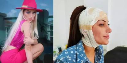 Barbie'ye benzeme sevdası canından etti: 27 kez ameliyat olan Fenomenin gizemli ölümü!