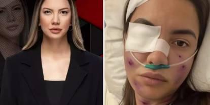 Fulya Öztürk'e ne oldu? Sevenlerini üzen o görselle ilgili açıklama geldi!