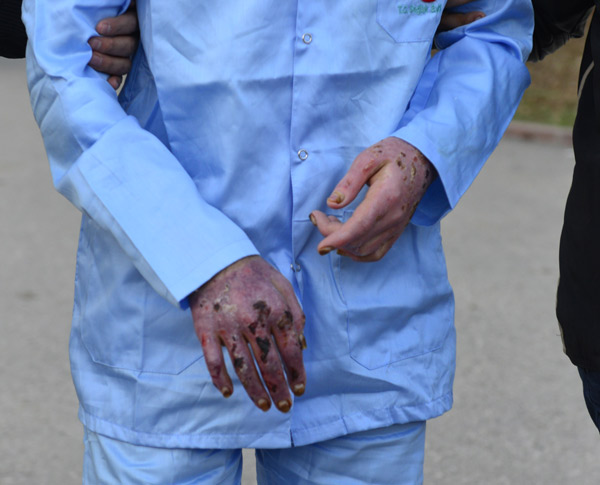 DEAŞ'lı teröristler hastanede yakayı ele verdiler