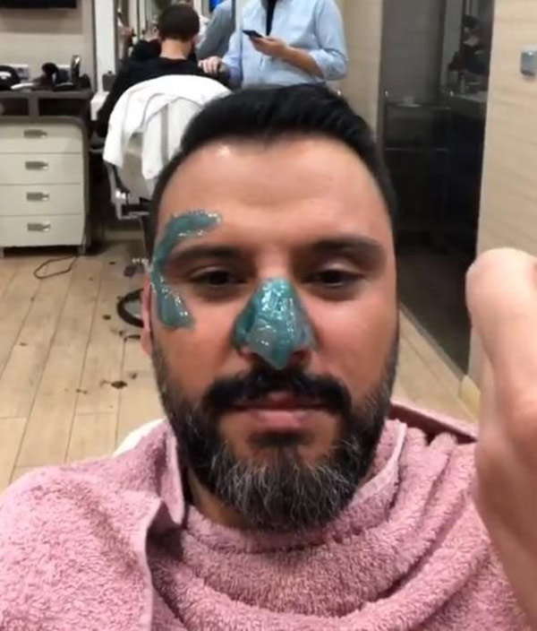 Alişan yeni dizisi için ağda yaptırdı