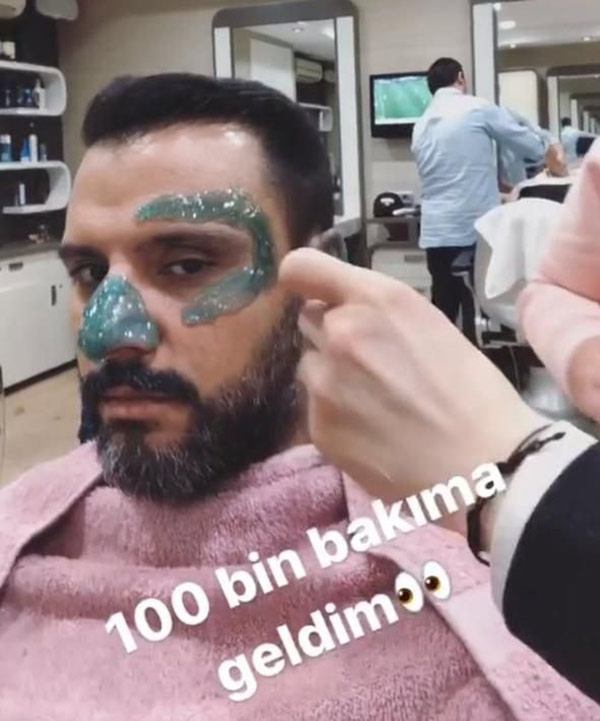 Alişan yeni dizisi için ağda yaptırdı