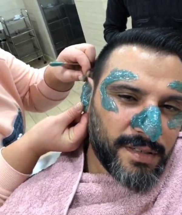 Alişan yeni dizisi için ağda yaptırdı