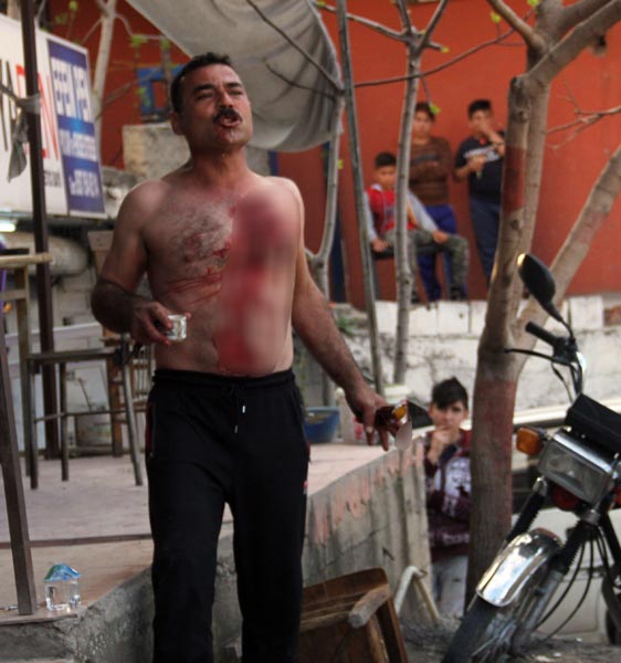 Adana'da Bir Suçlu Hem Kendini Kesti Hem Kahvesini İçti