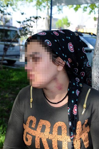 Adana'da Kayınbirader Dehşet: Önce Darp Etti Sonra Tecavüz