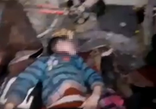 Doğu Guta'da Kimyasal Sarin Gazı Saldırısı: 80'den Fazla Ölü