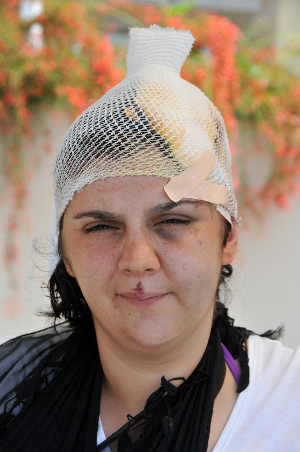 Antalya'da boşanmak isteyen kadın öldüresiye dayak yedi