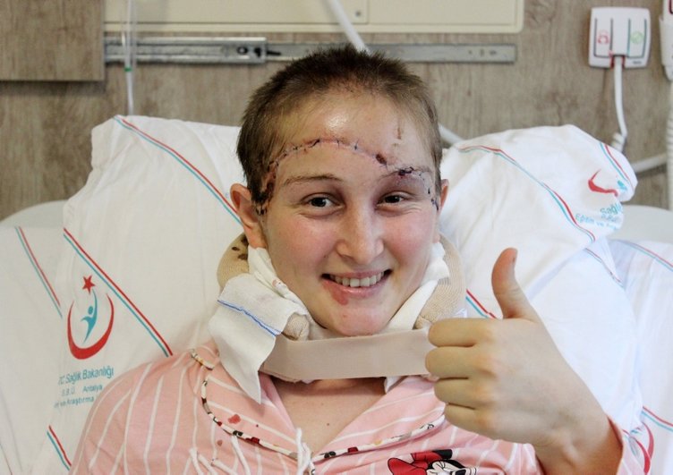 Baş derisi tamamen koptu! Kanlar içinde traktörü kullandı!