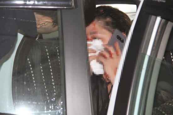 UBER Sürücüsü Kadın Yolcuyu Kanlar İçinde Bariyerlere Attı