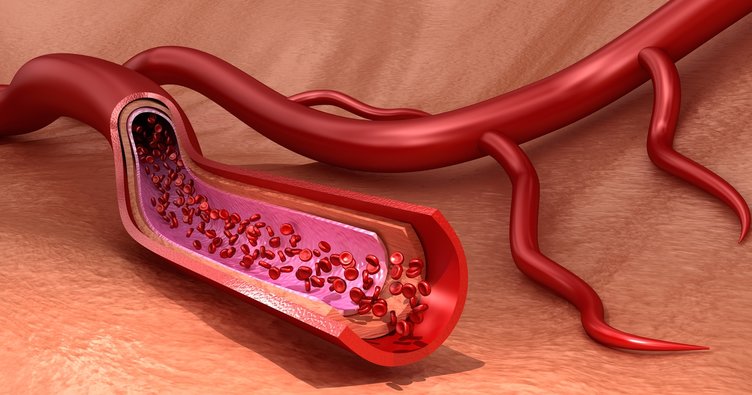 Kaçış Sendromu nedir? Nedeni nedir? Belirtileri nelerdir? Tedavisi nasıldır?