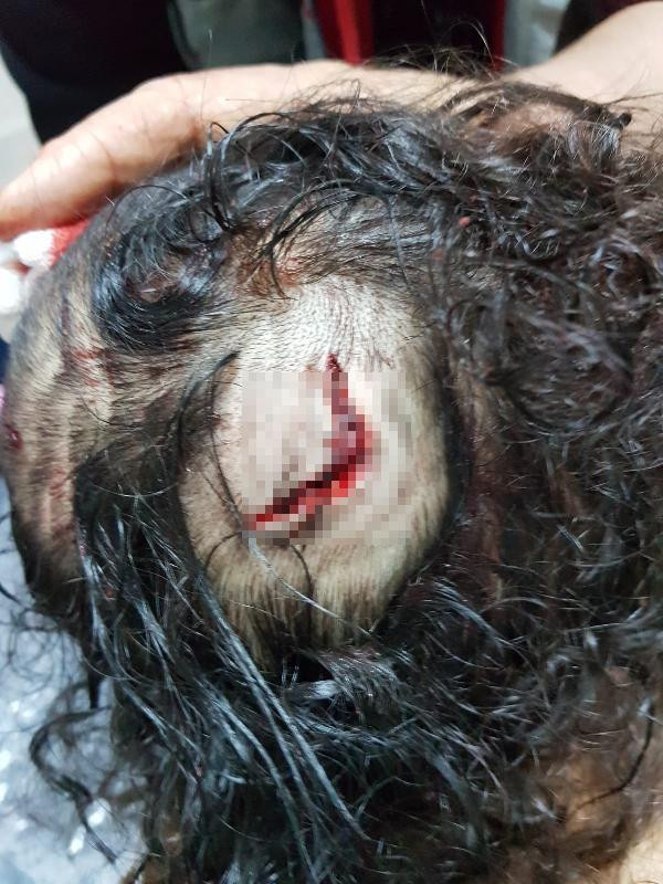 2 yaşındaki küçük kız köpeğin ağzından son anda kurtarıldı