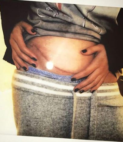 Selena Gomez'e Ne Oldu Sıcak Gelişme