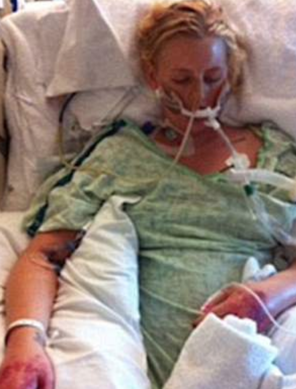 Lauren Wasser Kimdir | Toksik Şok Sendromu Nedir