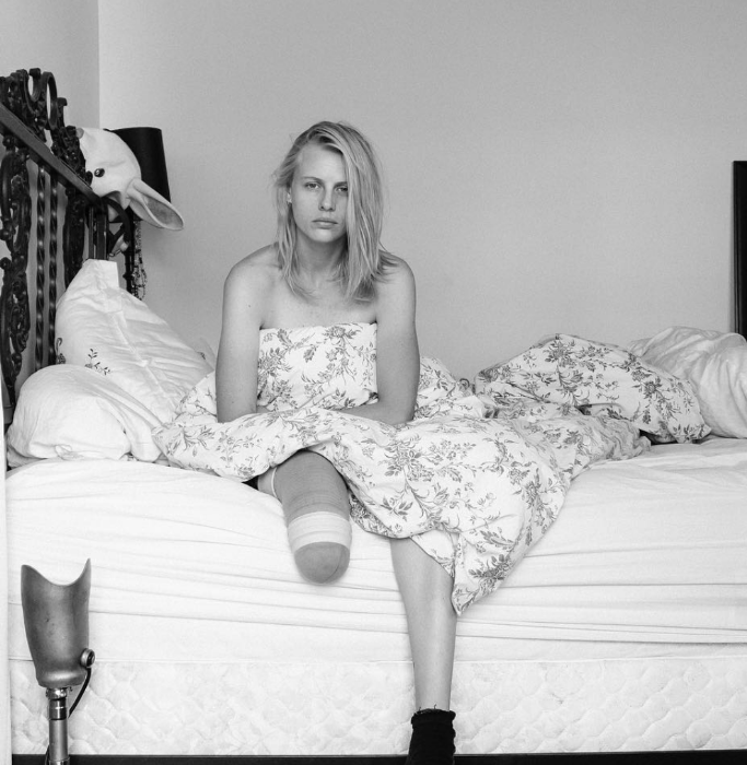 Lauren Wasser Kimdir | Toksik Şok Sendromu Nedir