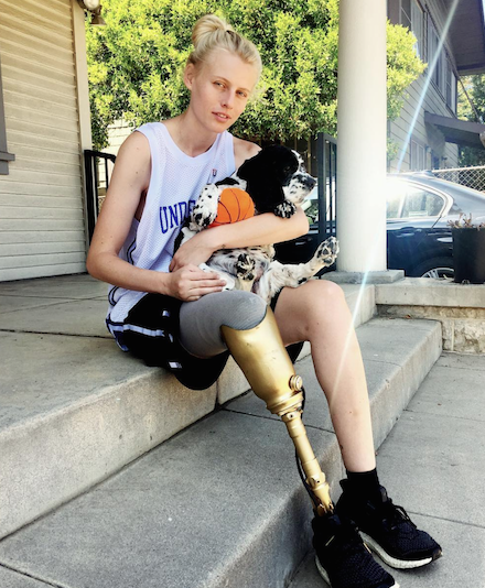 Lauren Wasser Kimdir | Toksik Şok Sendromu Nedir