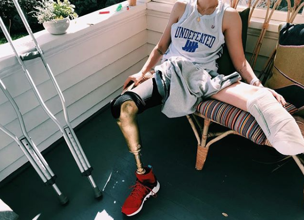 Lauren Wasser Kimdir | Toksik Şok Sendromu Nedir