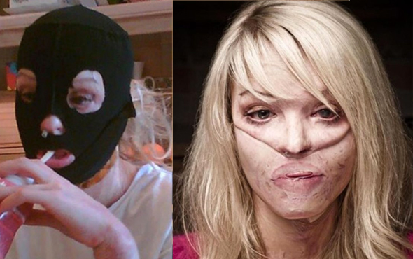 Eski sevgilisi tecavüz edip yüzüne asit fırlattı!