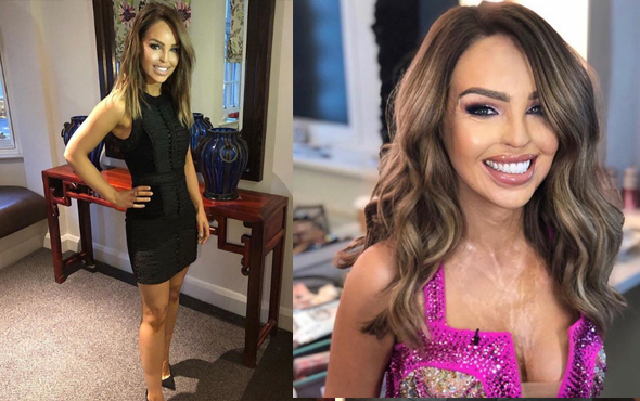 Eski sevgilisi tecavüz edip yüzüne asit fırlattı!