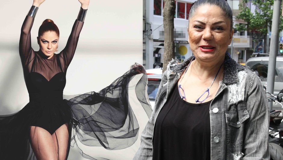 İzel'in son hali | Şarkıcı İzel'in yüzüne ne oldu?