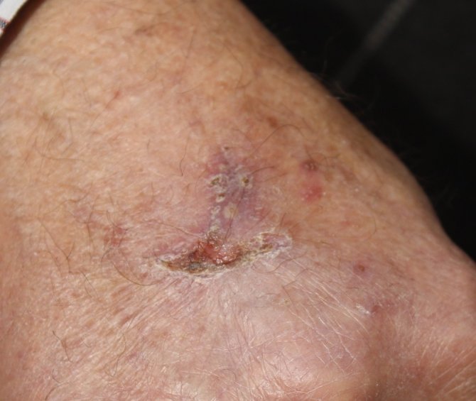 Madde Bağımlısı Babasını Bıçakladı Eve Almadı