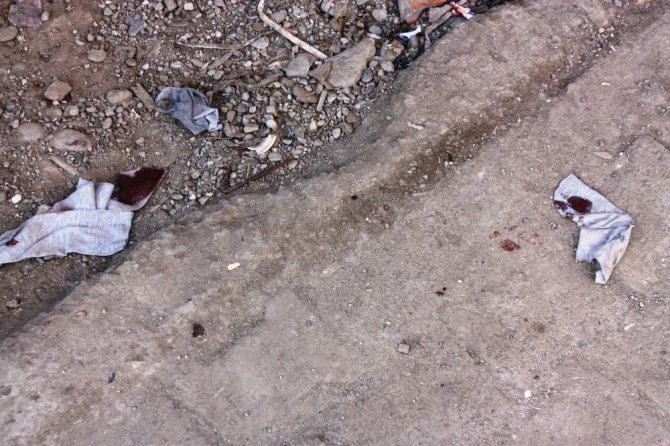 Diyarbakır'ın Kayapınar ilçesinde çıkan silahlı kavgada 1 kişi ayaklarına isabet eden kurşunla yaralandı.