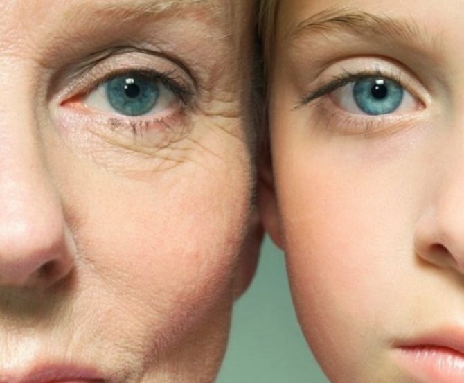 Dr. Jale Şenyurt Ağrısız ve acısız gençleşmenin yolu; İple yüz germe