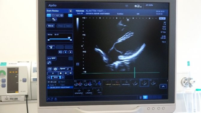 45 yaşındaki erkek hastanın Doğuştan kalp zarının bulunmadığı ortaya çıktı