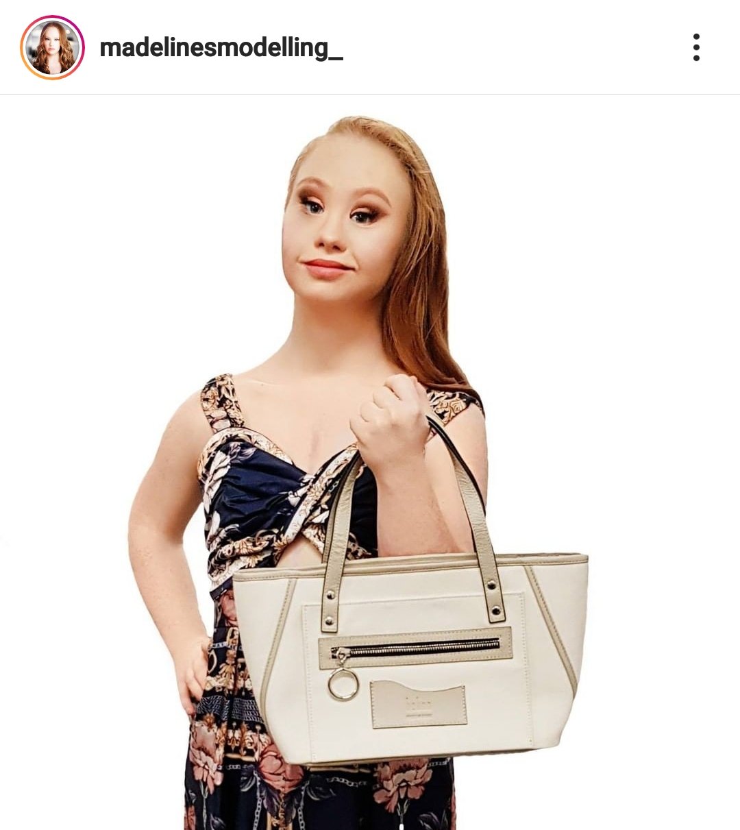 Dünyanın ilk down sendromlu modeli 