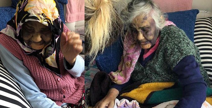 Zonguldak'ta kan donduran olay ! Yaşlı kadın bakıcısı tarafından dövüldü