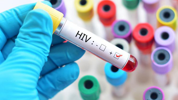 Konferans'da korkunç rakamlar! Türkiye'de HIV'li hasta sayısı 10 yılda yüzde 465 arttı