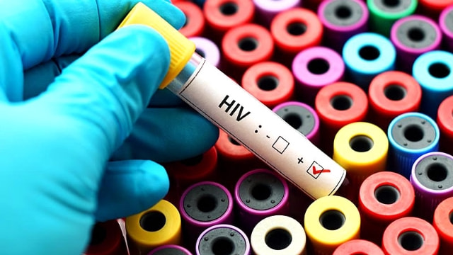 Konferans'da korkunç rakamlar! Türkiye'de HIV'li hasta sayısı 10 yılda yüzde 465 arttı