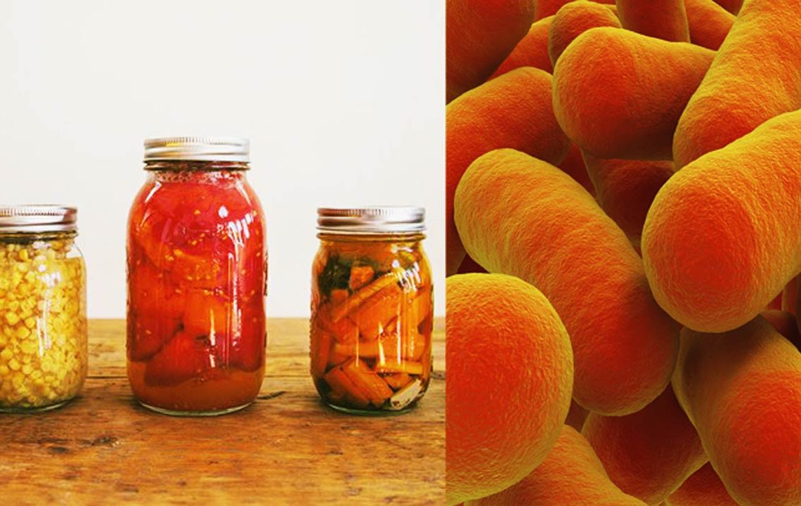 Botulizm tehlikesi neredeyse can alıyordu! Evde yaptıkları turşuyu yediler zehirlendiler...