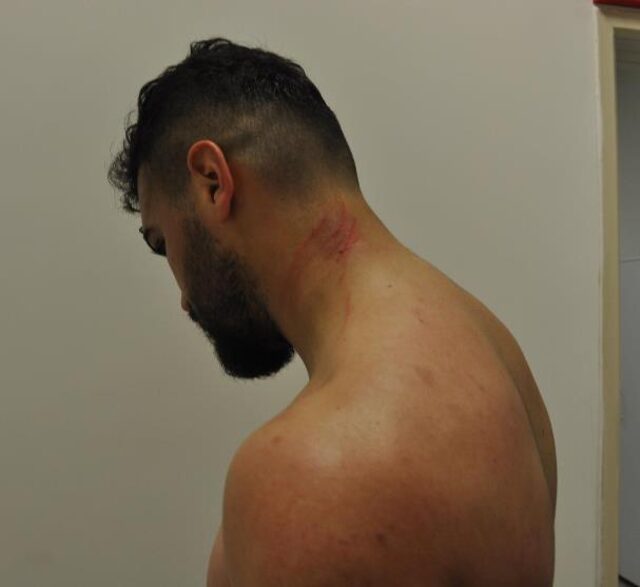 20 maç ceza alan Amedsporlu Mansur Çalar şimdi de tırnaklarıyla saldırdı