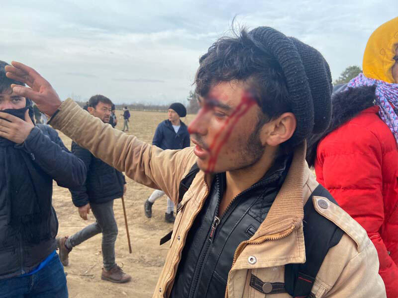 Yunan polisi ateş açtı: 1 göçmen öldü, 5 göçmen yaralandı