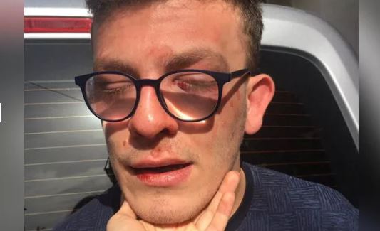 Avcılar'da otizmli gence dayak!