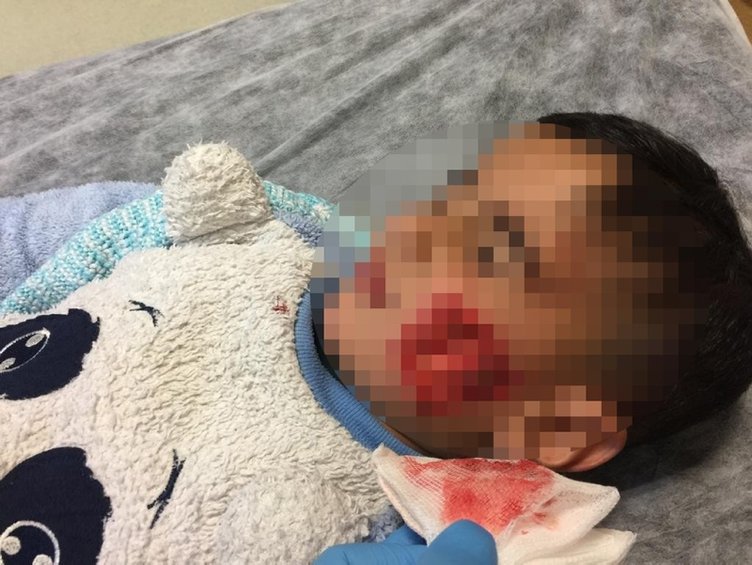 Şanlıurfa'da küçük çocuklar sokakta dehşeti yaşadı!