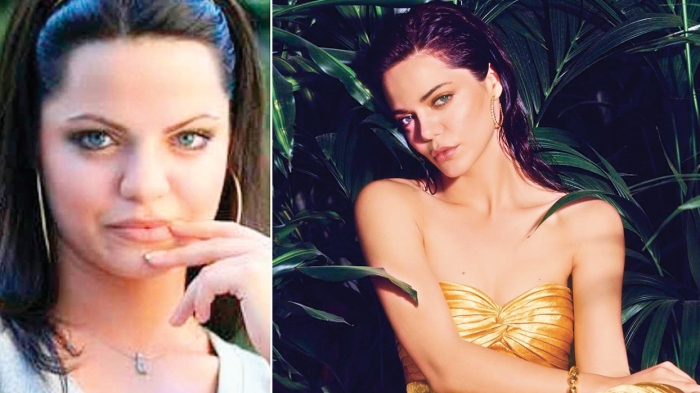 Hilal Altınbilek'ten estetik itirafı