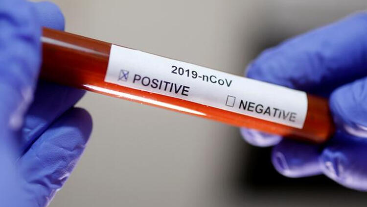 Türkiye 10 Mayıs Pazartesi koronavirüs takvimi