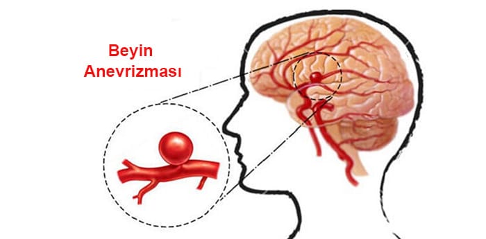 Andrea Rinaldi kimdir? | Andrea Rinaldi neden öldü?