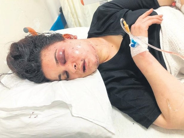 Genç kadına ormanda dehşeti yaşattılar! Kemiklerini kırıp kulağını kestiler