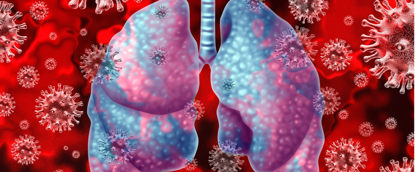 ABD'de koronadan ölü sayısı 99 bine yaklaştı!