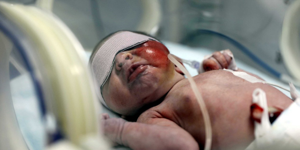 Gaziantep'te çöpte bulunan Duru bebekten güzel haber! Taburcu edildi